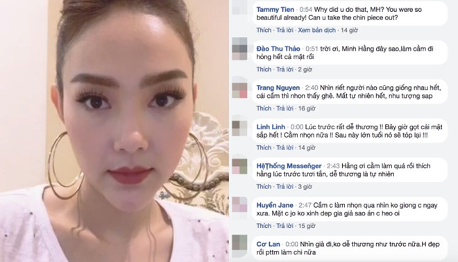 Ngỡ ng&agrave;ng trước gương mặt cứng đơ c&ugrave;ng chiếc cằm nhọn lệch của Minh Hằng