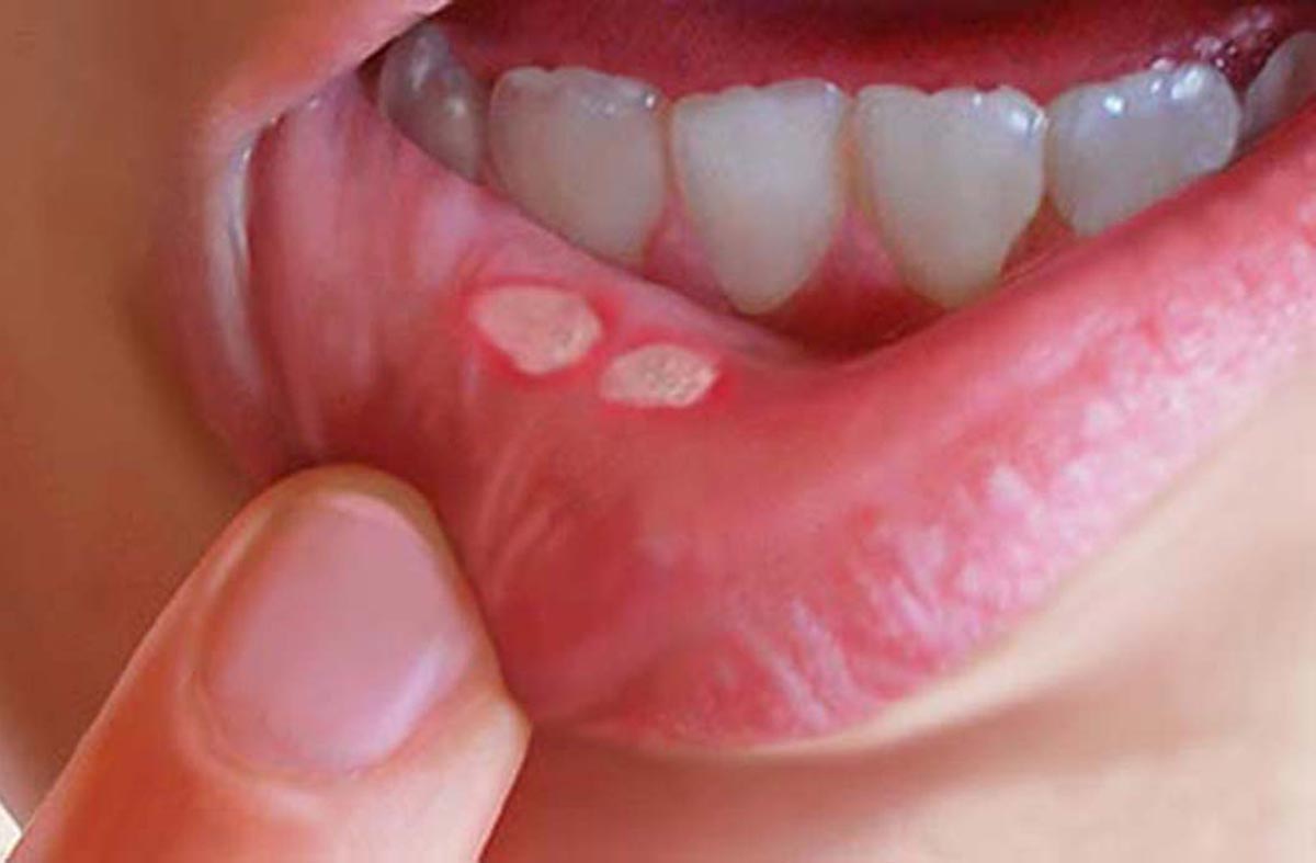 Điểm danh những người sẽ gặp phải rắc rối khi ăn nhiều quả vải