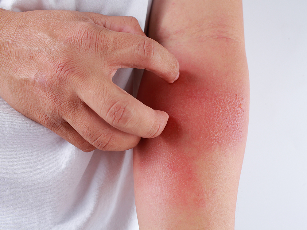 Những người n&agrave;y chớ ăn cua đồng kẻo rước họa v&agrave;o th&acirc;n