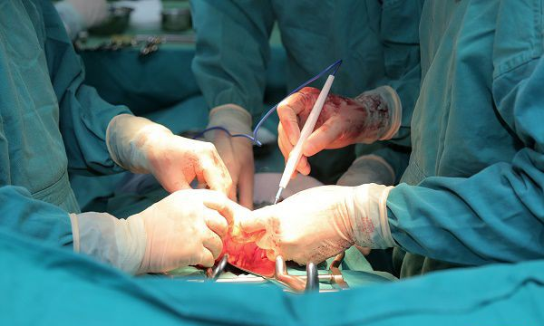 Ung thư buồng trứng: C&aacute;c phương ph&aacute;p điều trị hiệu quả nhất hiện nay