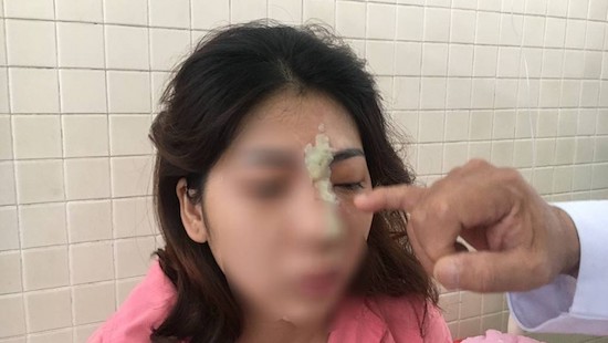 Li&ecirc;n tiếp c&aacute;c trường hợp m&ugrave; mắt sau khi l&agrave;m đẹp tại spa