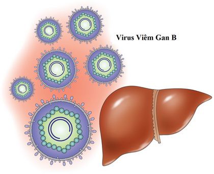 C&aacute;c loại virus g&acirc;y vi&ecirc;m gan l&acirc;u dần c&oacute; thể dẫn đến bệnh xơ gan