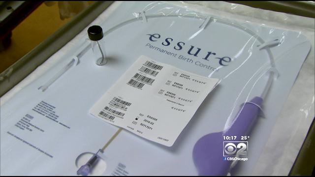 Biện ph&aacute;p tr&aacute;nh thai Essure c&oacute; thể g&acirc;y ra những t&aacute;c dụng phụ nguy hiểm đến 13Win19 ưu đãi hấp dẫn phụ nữ