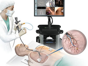 Các thiết bị nội soi phế quản có thể làm tăng nguy cơ nhiễm bệnh Các thiết bị nội soi phế quản có thể làm tăng nguy cơ nhiễm bệnh