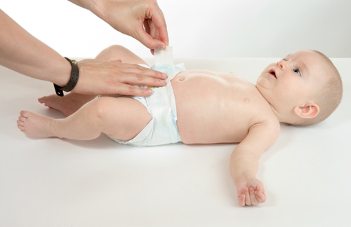 Việc đ&oacute;ng bỉm, t&atilde; giấy cho b&eacute; qu&aacute; thường xuy&ecirc;n c&oacute; thể g&acirc;y ra t&igrave;nh trạng hăm b&iacute;, nhiễm tr&ugrave;ng