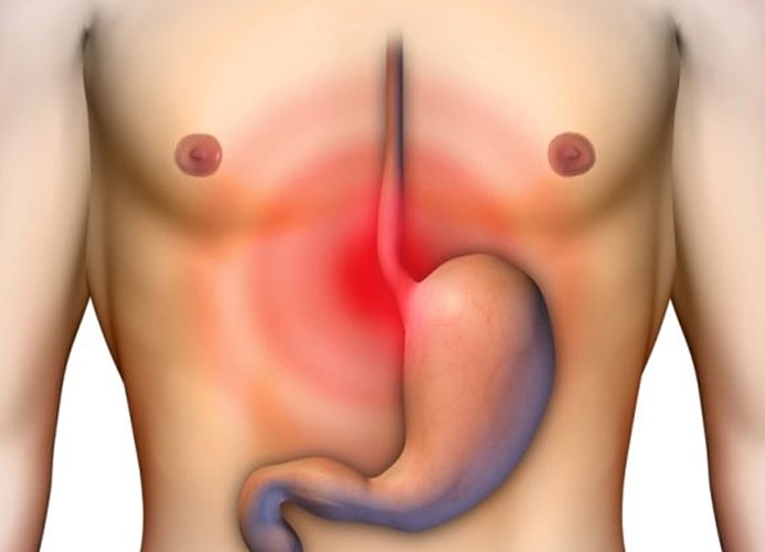 Ph&acirc;n đen hoặc c&oacute; m&agrave;u l&agrave; một dấu hiệu của bệnh ung thư dạ d&agrave;y
