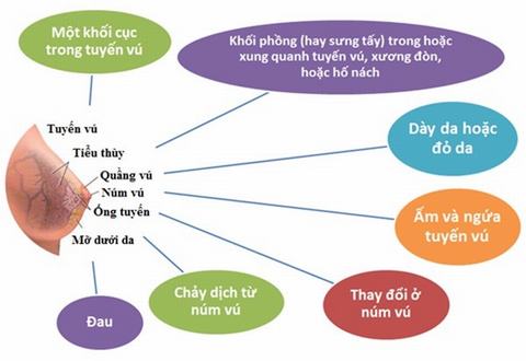 C&aacute;c dấu hiệu nhận biết ung thư v&uacute; m&agrave; c&aacute;c chị em c&oacute; thể tự kiểm tra tại nh&agrave;
