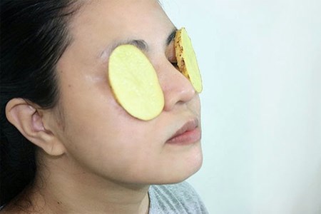 C&aacute;ch chăm s&oacute;c da, giảm quầng th&acirc;m mắt hữu hiệu nhờ khoai t&acirc;y
