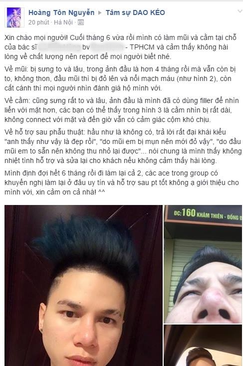 Ho&agrave;ng T&ocirc;n tiết lộ th&ocirc;ng tin phẫu thuật thẩm mỹ hỏng