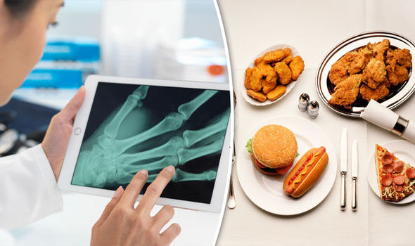 Chế độ dinh dưỡng ảnh hưởng kh&ocirc;ng nhỏ tới sự dẻo dai của xương khớp