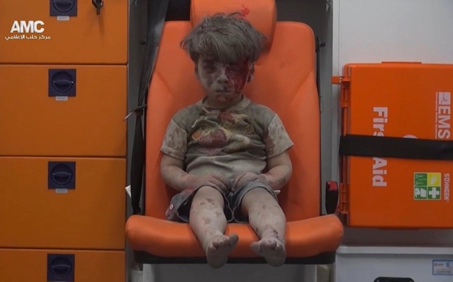 Bức ảnh chụp Omran Daqneesh, 5 tuổi, với ánh mắt đờ đẫn và gương mặt bết máu trên xe cứu thương hôm 17/8 trở thành hiện tượng trên mạng xã hội, lột tả cuộc chiến khốc liệt tại Aleppo giữa lực lượng chính phủ Syria và phe đối lập. Ảnh: AMC