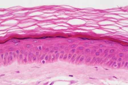 Ph&aacute;t minh mới c&ocirc;ng nghệ da nh&acirc;n tạo gi&uacute;p điều trị triệt để c&aacute;c căn bệnh ngo&agrave;i da