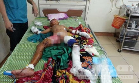 B&eacute; Long đang điều trị tại bệnh viện