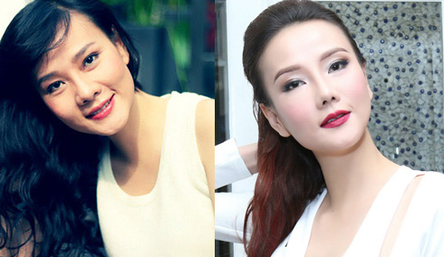 Dương Yến Ngọc trước v&agrave; sau khi thẩm mỹ lần thứ ba (phải)
