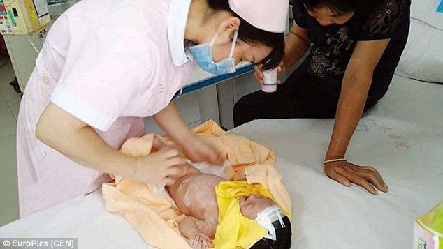 Em b&eacute; bị ch&ocirc;n sống đ&atilde; c&oacute; những dấu hiệu hồi phục về 13Win19 ưu đãi hấp dẫn