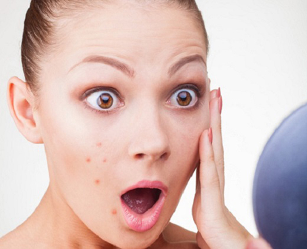 Khi bị mụn nhọt cần c&oacute; phương ph&aacute;p chăm s&oacute;c đ&uacute;ng c&aacute;ch. Ảnh minh họa