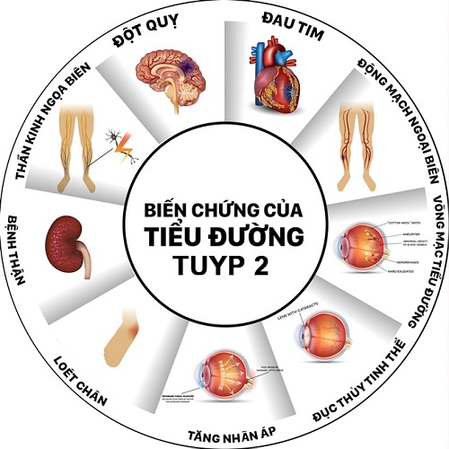 Biến chứng của bệnh đ&aacute;i th&aacute;o đường type 2. Ảnh: Sức khỏe & đời sống
