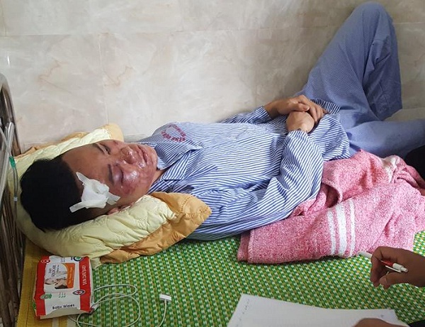 Nạn nh&acirc;n Thế anh đang cấp cứu tại bệnh viện
