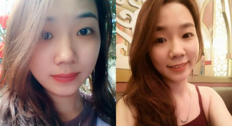 Tâm sự trên trang facebook cá nhân, nữ sinh bị tạt axit gửi tới cộng đồng thông điệp: “Nếu gặp trường hợp như tôi thì hãy cứng rắn, tự tin và hãy tin rằng rồi mọi chuyện sẽ ổn”.