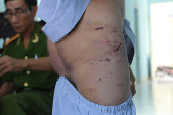 Chú tiểu bị đánh đập và hành hạ vì bị nghi là ăn cắp tiền chùa Chú tiểu bị đánh đập và hành hạ vì bị nghi là ăn cắp tiền chùa