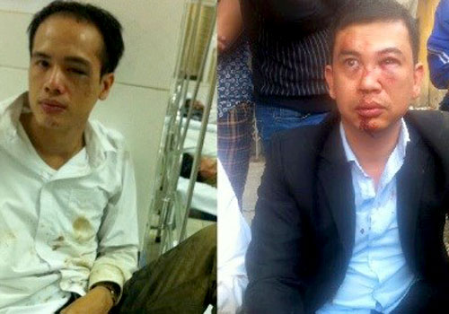 2 luật sư sau khi bị h&agrave;nh hung ở Chương Mỹ, H&agrave; Nội. 