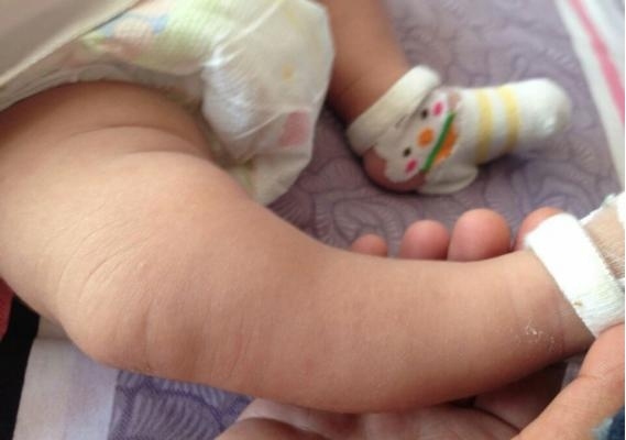 Mẹ mua gi&agrave;y rộng để 'trừ hao', kh&ocirc;ng ngờ hại con cả đời