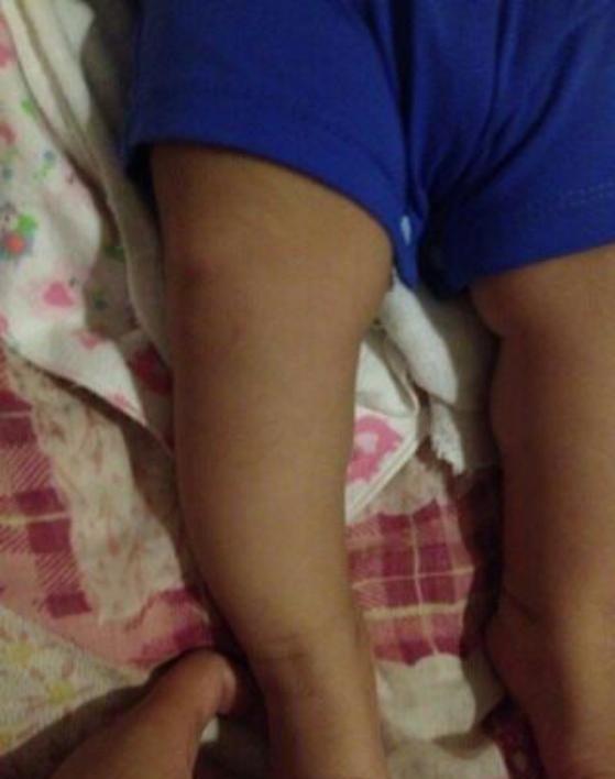 Mẹ mua gi&agrave;y rộng để 'trừ hao', kh&ocirc;ng ngờ hại con cả đời