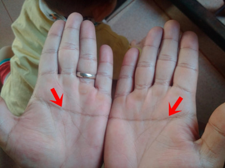 B&agrave;n tay c&oacute; đặc điểm n&agrave;y kh&ocirc;ng ph&uacute; cũng qu&yacute;, cả đời may mắn