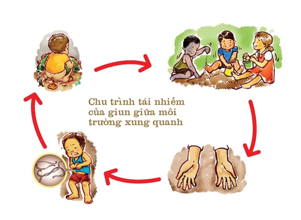 Ngứa da nổi mề đay l&agrave; do nhiễm giun s&aacute;n?