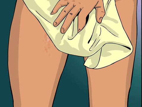 Ngứa da nổi mề đay l&agrave; do nhiễm giun s&aacute;n?