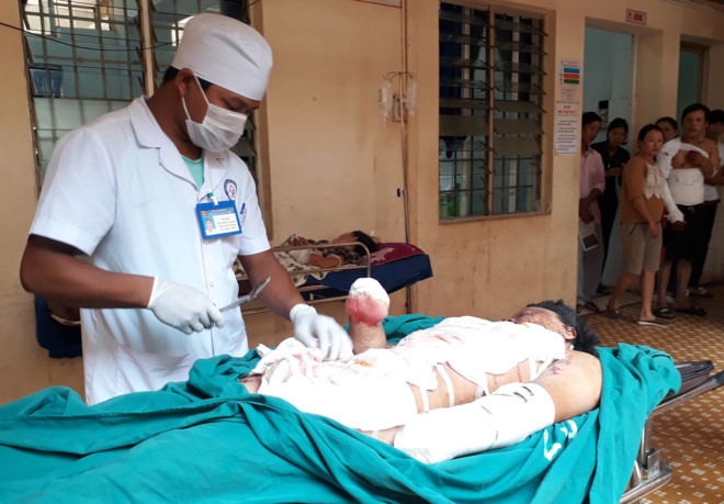 Từ vụ thiếu ni&ecirc;n mất hai tay, giải m&atilde; hiện tượng trộn lẫn ph&acirc;n b&oacute;n g&acirc;y ch&aacute;y nổ