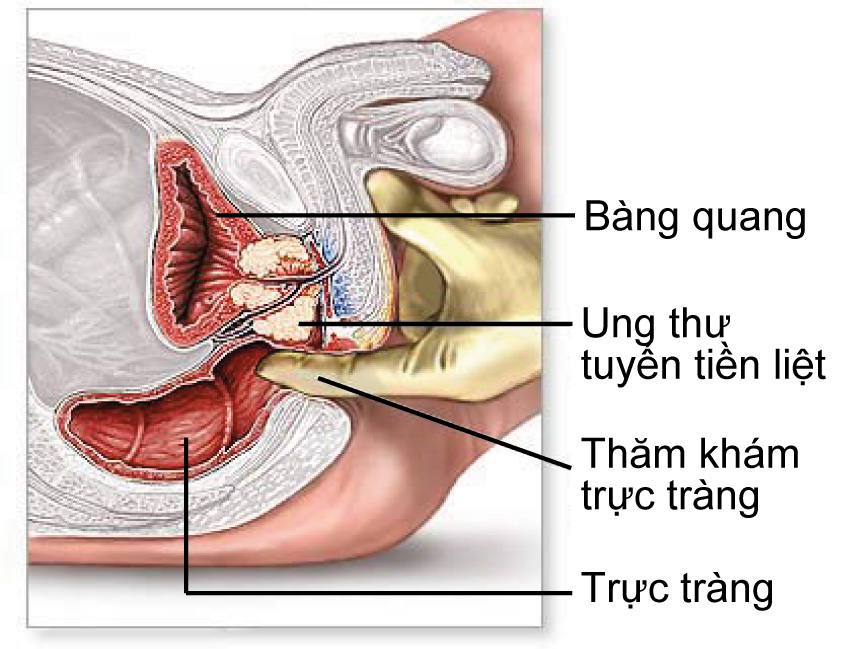 Căn bệnh khiến nhạc sĩ T&ocirc; Thanh T&ugrave;ng suốt 2 năm gần như nằm liệt một chỗ nguy hiểm đến mức n&agrave;o?
