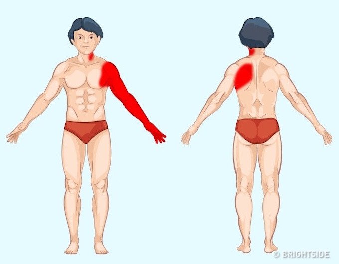 Vị tr&iacute; cơn đau cảnh b&aacute;o bệnh nguy hiểm ai cũng n&ecirc;n biết để tự chuẩn đo&aacute;n