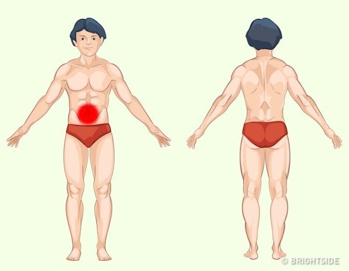 Vị tr&iacute; cơn đau cảnh b&aacute;o bệnh nguy hiểm ai cũng n&ecirc;n biết để tự chuẩn đo&aacute;n