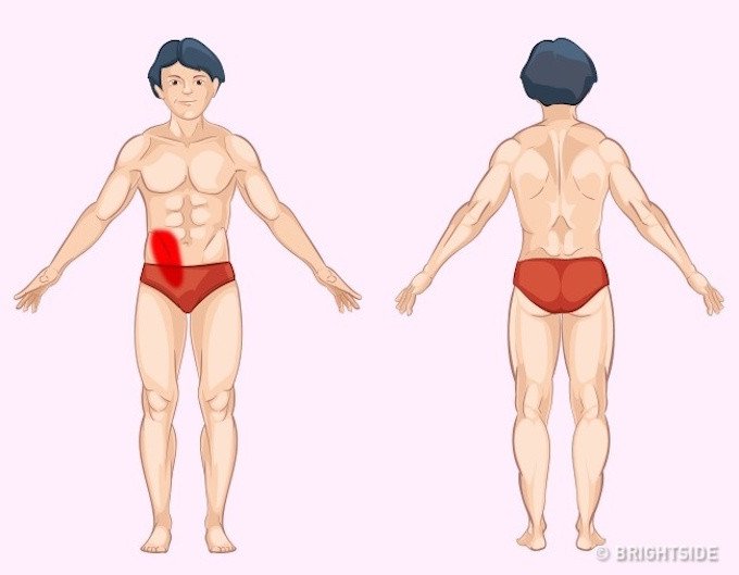 Vị tr&iacute; cơn đau cảnh b&aacute;o bệnh nguy hiểm ai cũng n&ecirc;n biết để tự chuẩn đo&aacute;n