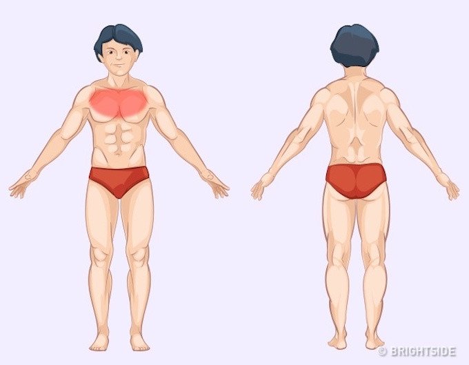 Vị tr&iacute; cơn đau cảnh b&aacute;o bệnh nguy hiểm ai cũng n&ecirc;n biết để tự chuẩn đo&aacute;n