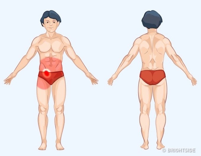 Vị tr&iacute; cơn đau cảnh b&aacute;o bệnh nguy hiểm ai cũng n&ecirc;n biết để tự chuẩn đo&aacute;n