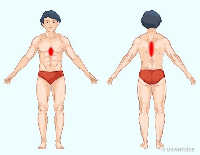 Vị tr&iacute; cơn đau cảnh b&aacute;o bệnh nguy hiểm ai cũng n&ecirc;n biết để tự chuẩn đo&aacute;n