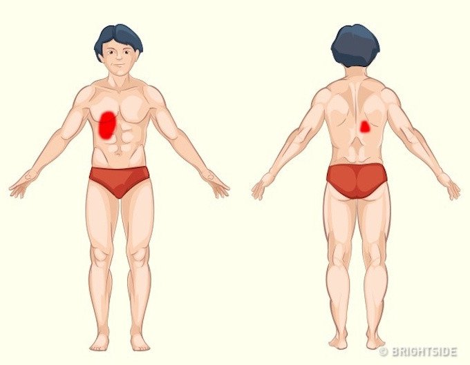 Vị tr&iacute; cơn đau cảnh b&aacute;o bệnh nguy hiểm ai cũng n&ecirc;n biết để tự chuẩn đo&aacute;n