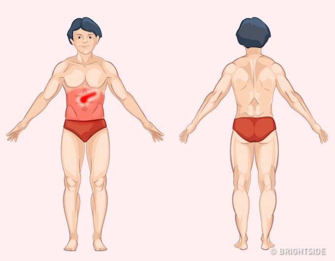 Vị tr&iacute; cơn đau cảnh b&aacute;o bệnh nguy hiểm ai cũng n&ecirc;n biết để tự chuẩn đo&aacute;n