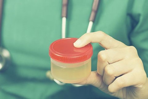 Màu sắc nước tiểu cảnh báo bệnh nguy hiểm không phải ai cũng biết Màu sắc nước tiểu cảnh báo bệnh nguy hiểm không phải ai cũng biết