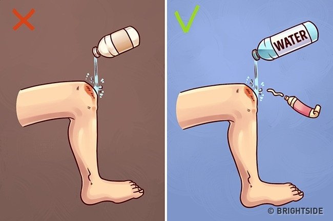 H&oacute;a ra bấy l&acirc;u nay ch&uacute;ng ta đều đang sơ cứu sai c&aacute;ch m&agrave; kh&ocirc;ng hay biết