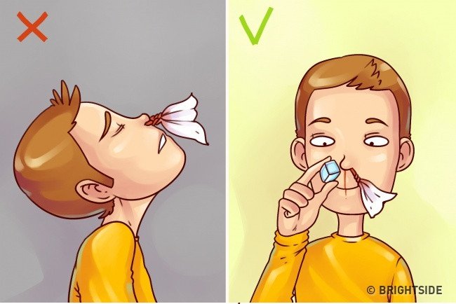 H&oacute;a ra bấy l&acirc;u nay ch&uacute;ng ta đều đang sơ cứu sai c&aacute;ch m&agrave; kh&ocirc;ng hay biết