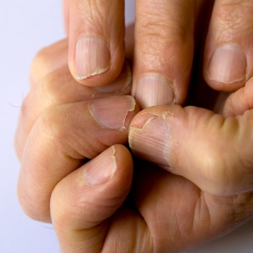 2 L&yacute; do sẽ khiến bạn cả đời kh&ocirc;ng d&aacute;m... qu&ecirc;n rửa tay trước khi ăn