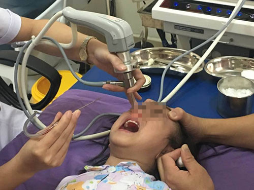 Đừng bao giờ để gần trẻ nhỏ vật n&agrave;y - v&igrave; đ&acirc;y sẽ l&agrave; hậu quả khủng khiếp xảy ra