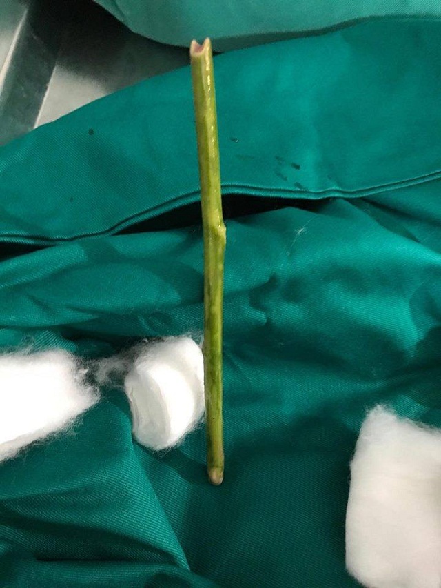 C&ocirc; g&aacute;i 27 tuổi nguy kịch v&igrave; tự ph&aacute; thai bằng thảo dược v&agrave; đặt que v&agrave;o &acirc;m đạo để cầm m&aacute;u