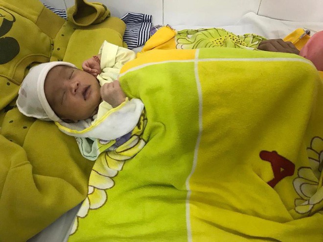 B&eacute; g&aacute;i 16 ng&agrave;y tuổi mắt nổi bong b&oacute;ng, lo&eacute;t thủng gi&aacute;c mạc v&igrave; 'mẹo' nhỏ sữa mẹ v&agrave;o mắt