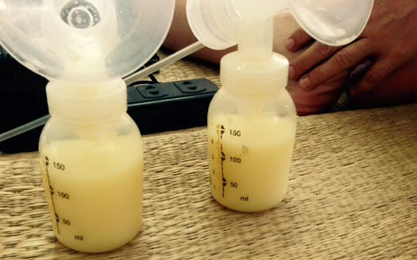 B&eacute; g&aacute;i 16 ng&agrave;y tuổi mắt nổi bong b&oacute;ng, lo&eacute;t thủng gi&aacute;c mạc v&igrave; 'mẹo' nhỏ sữa mẹ v&agrave;o mắt