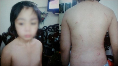 H&agrave;nh tr&igrave;nh bỏ trốn đau đớn khỏi nh&agrave; bố v&agrave; mẹ kế của ch&aacute;u b&eacute; 10 tuổi bị bạo h&agrave;nh