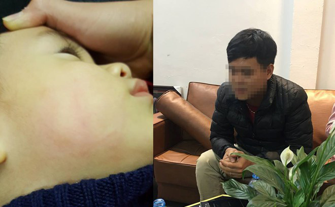 B&eacute; trai 22 th&aacute;ng tuổi bị b&aacute;c sĩ t&aacute;t đỏ mặt: Bộ Y tế y&ecirc;u cầu kiểm tra v&agrave; xử l&yacute; nghi&ecirc;m khắc